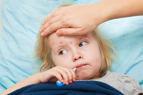 <b>K�zam�k:</b> 2000 y�l�nda Amerika'da MMR a��s� sayesinde �ocuklarda k�zam�k hastal���n�n yok edildi�i duyurulmu�tu. Ancak ge�ti�imiz y�llarda a�� oranlar�ndaki azalmaya ba�l� olarak bu �lkede k�zam�k salg�nlar� g�r�ld�. K�zam�kta a��lama �nlemenin �nemi b�y�kt�r. A��n�n ilk dozu �ocuk 12-15 ayl�k oldu�unda yap�l�yor. Daha sonra ise �ocuk okul �a��nda tekrar dozu yap�l�yor.