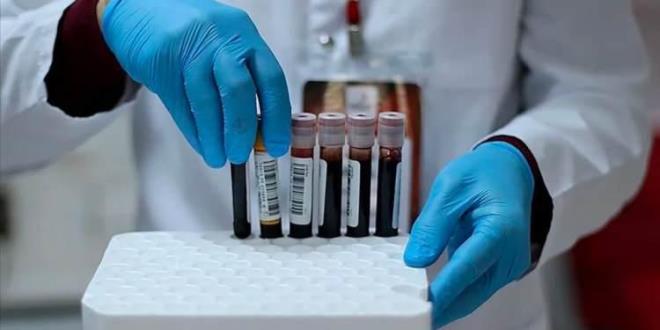 A Kan Grubu: Yaratc, dnceli, organize ve hassas olabilirler. Bu gruptakilerin duygusal zeka seviyeleri genellikle yksektir.