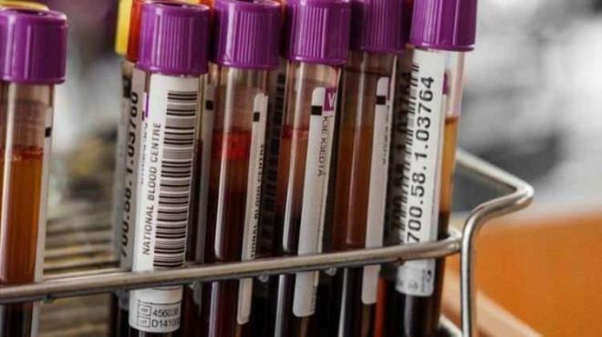 Japonya'da gerekletirilen bir aratrma, kan grubunun kiilik zelliklerimizi belirlediini ortaya kard. Bu ilgin teori, A, B, 0 ve AB kan gruplarnn benzersiz kiilik zellikleri tadn ne sryor. zellikle ilerinden bir tanesi doutan zeki! te kan gruplarna gre kiilik zellikleri...