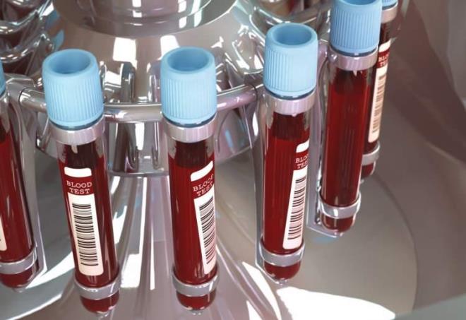 Japonya'da A kan grubuna sahip kiilerin saysnn dier kan gruplarna gre daha fazla olduu syleniyor.