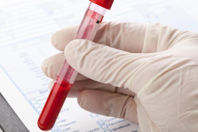 Kan grubu A olan kiilerin mide kanseri ve kalp hastalna yakalanma riskinin daha yksek olduu biliniyor. Kan grubu B olan kiilerde kalp hastal, yumurtalk kanseri riski de yksektir.