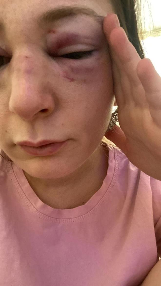 ''OCUKLARIMI KAIRMAKLA TEHDT ETT''    Sibel Kahraman ise ifadesinde, kendisine cinsel ierikli mesajlar att gerekesiyle ayrld rfan ahin'in, daha nce de ocuklarn karmakla tehdit ettiini syledi.    ahin'den daha nce de iddet grdn iddia eden Kahraman, "rfan, yalan sylyor. Her gittiimiz mekanda zorla beni dar karyor. Olay gn kolumdan beni darya kard gn gvenlik grevlilerine kam kaldrarak, zor durumdaym deyip yardm istedim. Bana defalarca kafa att. Aracn yol kenarna ekip kafa att. Hepsini hatrlyorum. rfan ahin, gemi zamanlarda vcudumda defalarca sigara sndrd. ikayetim devam ediyor." diye konutu.