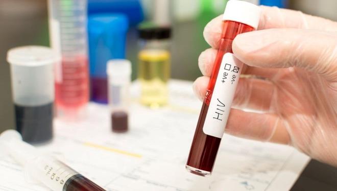 HIV/AIDS BELRTLER NELERDR?    HIV virs ile enfekte olan kiide ate, terleme, dknt, boaz, ars, yorgunluk ve az lserleri grlr, HIV'in 3. aamas olan aids durumunda hzl kilo kayb, tekrarlayan ate ve geceleri sklaan terlemeler, ar yorgunluk, lenf bezlerinde ime, hafza kayb ve depresyon gibi nrolojik sorunlar, az, makat ve cinsel organda yara olumas gibi belirtiler ortaya kar.    HIV virsnn ileri aamas olan AIDS belirtileri unlardr:    Koltuk alt, kask veya boyundaki lenf bezlerinde ime  Ar yorgunluk  Kilo kayb  Sk sk atelenme ve gece terlemeleri  Az iinde yara oluumu (az lseri, pamukuk)  Deri dkntleri ve ciltte pullanma  Uzun sreli ishal  Cinsel organda mantar enfeksiyonlarnda sklk  Akcierde iltihaplanma  Ciltte krmz, kahverengi, pembe veya morumsu lekeler  Hafza kayb ve depresyon gibi nrolojik sorunlarn gelimesi  Boaz ars