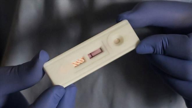 HIV/AIDS NEDEN OLUR?    HIV, vcudun hastalklarla mcadele etmesine yardmc olma konusunda byk rol oynayan beyaz kan hcreleri olan CD4 T hcrelerini yok eder. Kii ne kadar az CD4 T hcresine sahip olursa baklk sistemi de bir o kadar zayflar.    AIDS'e dnmeden yllar nce ok az belirti veya hi semptom gstermeden HIV enfeksiyonu geirilmesi mmkndr. AIDS tans, CD4 T hcre says 200'n altna dtnde veya ciddi bir enfeksiyon, kanser gibi AIDS'i tanmlayan bir komplikasyona sahip olunduunda konur.    Tedavisi olmad iin kronik bir ekilde kiinin vcudunda mr boyu kalr ancak ilalarla birlikte kontrol altna alnmaya allr.