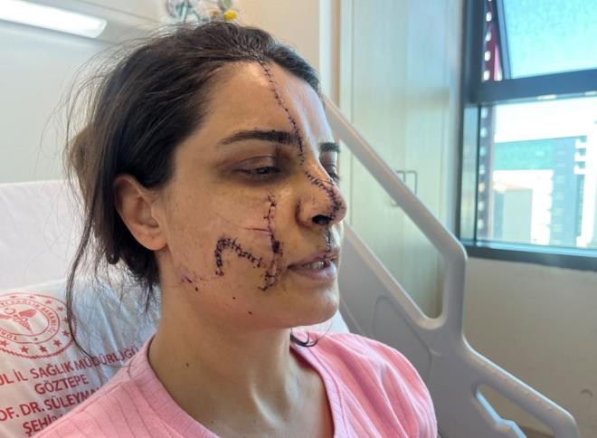 Karadereli, 8 Mart Dnya Kadnlar gnnde de Akay tarafndan tehdit edildiini belirterek, ?Gl ve dirayetli olmamz gerek. Bizler deerliyiz, inallah hibir kadn benim durumuma dm. Benim durumuma derseler bile ltfen su duyurusunda bulunsunlar, saklamasnlar. 8 Mart Dnya Kadnlar Gn'nde farkl bir numaradan beri arayarak, 'Beni iimden edersen, seni ldrrm, keserim' dedi. Bu tehdidi de 8 Mart Dnya Kadnlar Gn'nde yapt" dedi.