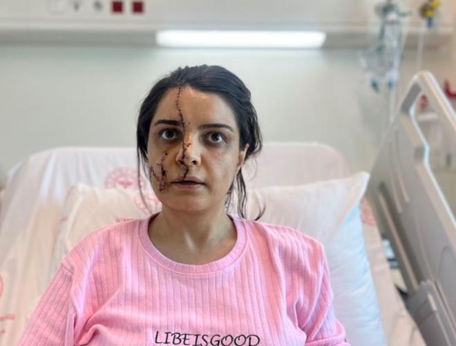 "AZINDA MASKE, KAFASINDA KAPON EKLNDE"    Hastane yatanda yaadklarn anlatan Karadereli, "Yaklak 2 senedir taknt ve saplantl halde olan etin Aktay tarafndan taciz edildim. Artk bu durum beni ar derece rahatsz etmeye balamt. Israrl takip, taciz, tehdit? Srekli bu ekilde mesajlar ve aramalar alyordum. ahs tarafndan hem i hem zel hayatmda her yerde takip ediliyordum. Son 1 yldr ise aznda maske, kafasnda kapon eklinde takip edildim. Bu konular ile alakal ltfen cezalarn artrlmasn istiyorum. Durumlar bu hale gelmeden, srtmdan yaralanmadan, yzmden yaralanmadan nce bir tedbir alnsayd belki bu hale gelmeyecektim. Tedbirlerin artrlmasn istiyorum. Bu kii elini kolunu sallayarak gezmesin. Bugn benim canm yakan, yarn bakasnn cann yakar." dedi.