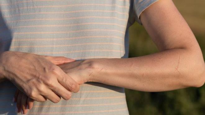 A vitamini eksikli�i belirtileri nelerdir?<p>  Bu vitamin v�cudumuzda gerekli miktarda olmad��� zaman �zellikle cilt ve v�cut sa�l���nda belirtiler ortaya ��kar. Kuruluk ve pul pul d�k�lme en yayg�n olan semptomlardan biri olabilir. Y�z, el ve ayaklar�n�zda pul pul d�k�lmeler ve a��r� kuruluk oluyorsa A vitamini eksikli�iniz olabilir.