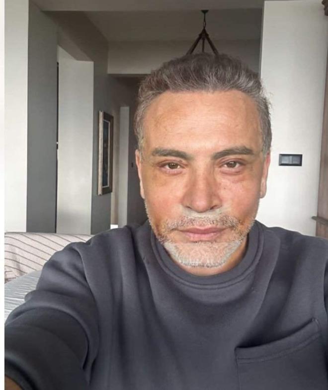 Magazin gndemine damga vuran arkc, yznde yapt deiikliklerle bambaka bir grnme sahip olmutu.