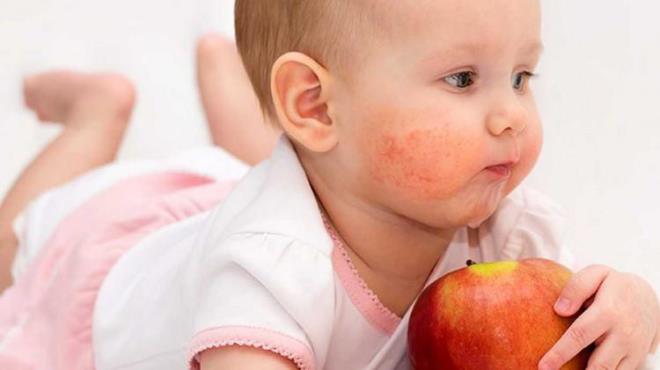 4-6 aydan 5 yana kadar yer fst tketen ocuklarn, tketmeyen ocuklara kyasla yer fstna alerji gelitirme ihtimalinin ok daha dk olduu ortaya kt.