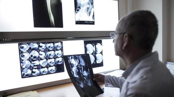 Kibrit kutusu byklnde ve yaklak yarm santimetre kalnndaki cihaz kablosuz olarak arj edilebiliyor. 7 aylk srete Epilepsi nbetlerini yzde 80 orannda azaltt ifade ediliyor.