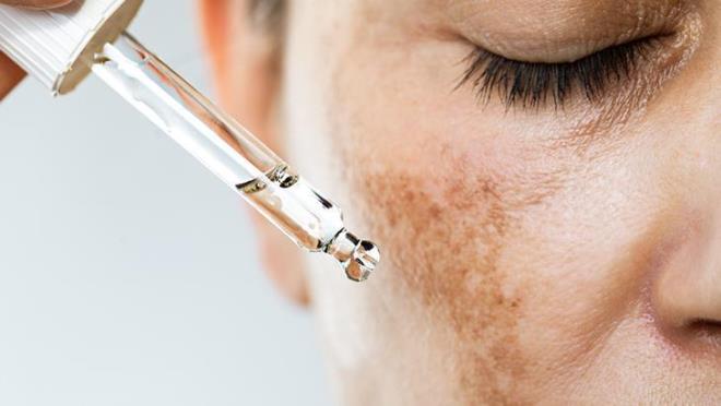 Tad gzel olsa da eker aslnda cildiniz iin ktdr. Cildinizin elastikiyetinden sorumlu bir bileen olan kolajeni paralar.