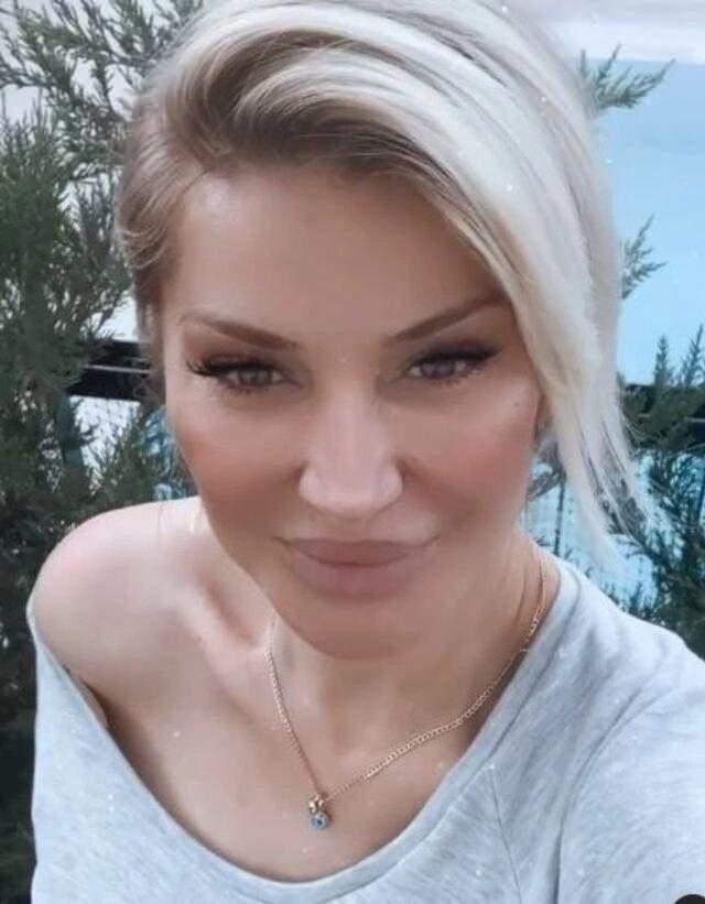 Birok nl isim gibi deiim iin operasyon masasna yatan arkc Songl Karl, estetik ilemlerin ardndan grnmn tamamen deitirdi. Son halleri ile Hadise'ye benzetilen Songl Karl, spor yapamaya ve dengeli beslenmeye de dikkat ediyor.