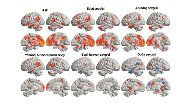 Aratrmaclar, katlmclara 6 farkl sevgi biimini harekete geirecek hikayeler anlatt: evlat sevgisi, arkada sevgisi, doa sevgisi, evcil hayvan sevgisi, ak ve yabancya duyulan sevgi. Sonulara gre, beyindeki aktivite sevginin nesnesine bal olarak farkllk gsterdi. rnein, bir insana duyulan sevgi ile evcil hayvan veya doa sevgisi beynin farkl blgelerini harekete geirdi.    Aratrmann en dikkat ekici bulgusu, insanlara duyulan sevgi trleriyle ilikili beyin blgelerinin olduka benzer olmasyd. Ancak bu blgelerin aktivasyon dereceleri deikenlik gsterdi. En gl beyin aktivitesinin evlat sevgisinde gzlendii belirtilirken, onu ak takip etti.