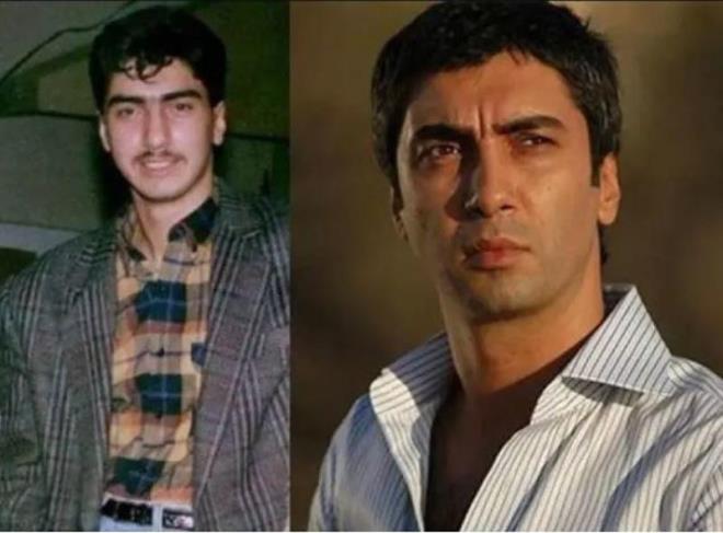 Necati amaz nam- dier Polat Alemdar'n da botoks ve dolgu ilemlerine bavurmu olduu grnyor.