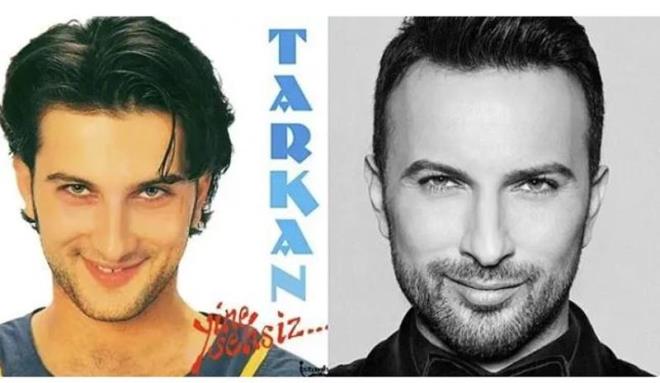 Tarkan yllar iindeki deiiminde en nemli detayn di estetii olduu grlyor.