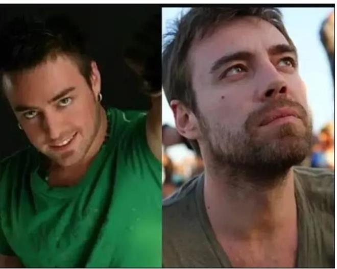 Murat Dalkl'da estetik operasyonuna bavuran nller kervanna katlyor. Birka kez burun estetii ve tabii geen yllar...