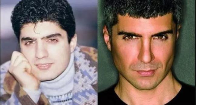 Botoks, dolgu, jawline ve burun estetiklerini yaptrd grlen zcan Deniz estetik yardmyla yllara meydan okuyor.