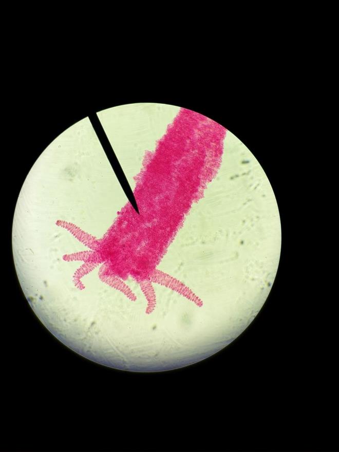 SON 10 YILDA TAZMANYA CANAVARLARINI YOK ETT     Yaplan almalar, kahverengi hidralarn yalnzca laboratuvar ortamnda kanser gelitirdiini gsterse de, bu tr tmrlerin son on ylda Avustralya kylarndaki Tazmanya canavarlarnn neredeyse yok olmasna neden olduu biliniyor.    Aratrma ekibi, evresel kirliliin daha bulac kanser trlerine yol aabileceinden endie ederken, bu hastaln insanlara etkisinin henz net olmadn vurgulad.