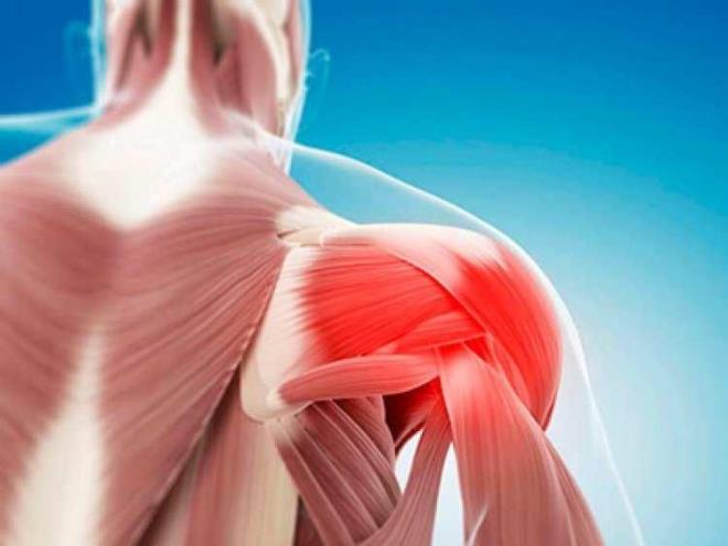 Yaplan tetkikler sonucunda rabdomiyoliz (rabdo) tehisi alan gen kadn, kaslarnn paralanp kanna zararl maddeler sald ciddi rahatszl renmesi zerine hayrete dt.