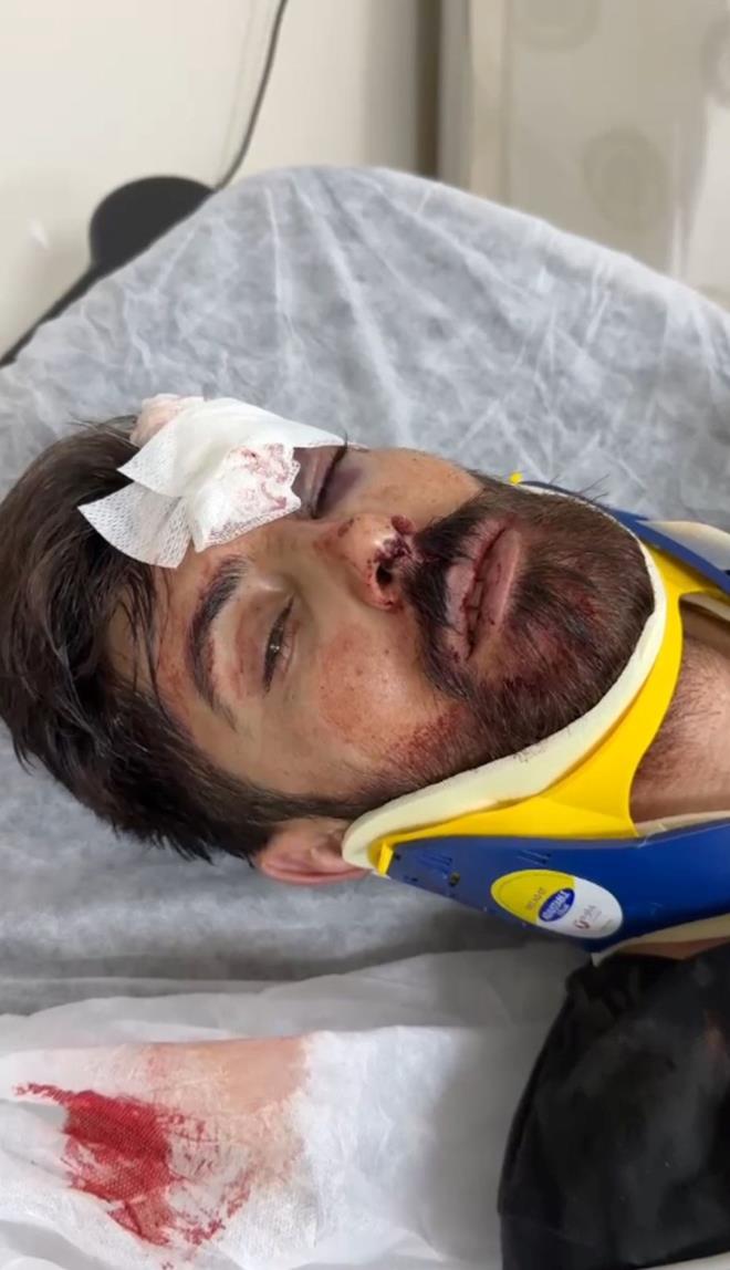 Y�ld�r�c�'n�n organlar�n�n, ailesi taraf�ndan ba���land��� ��renildi.