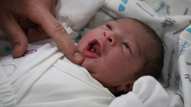 112 acil ar merkezinde, zel hastanelerdeki baz doktorlar be hemirelerle anlap bir su a oluturan yenidoan etesinin bebekleri haksz kazan salamak iin youn bakmda beklettikleri ortaya kt.