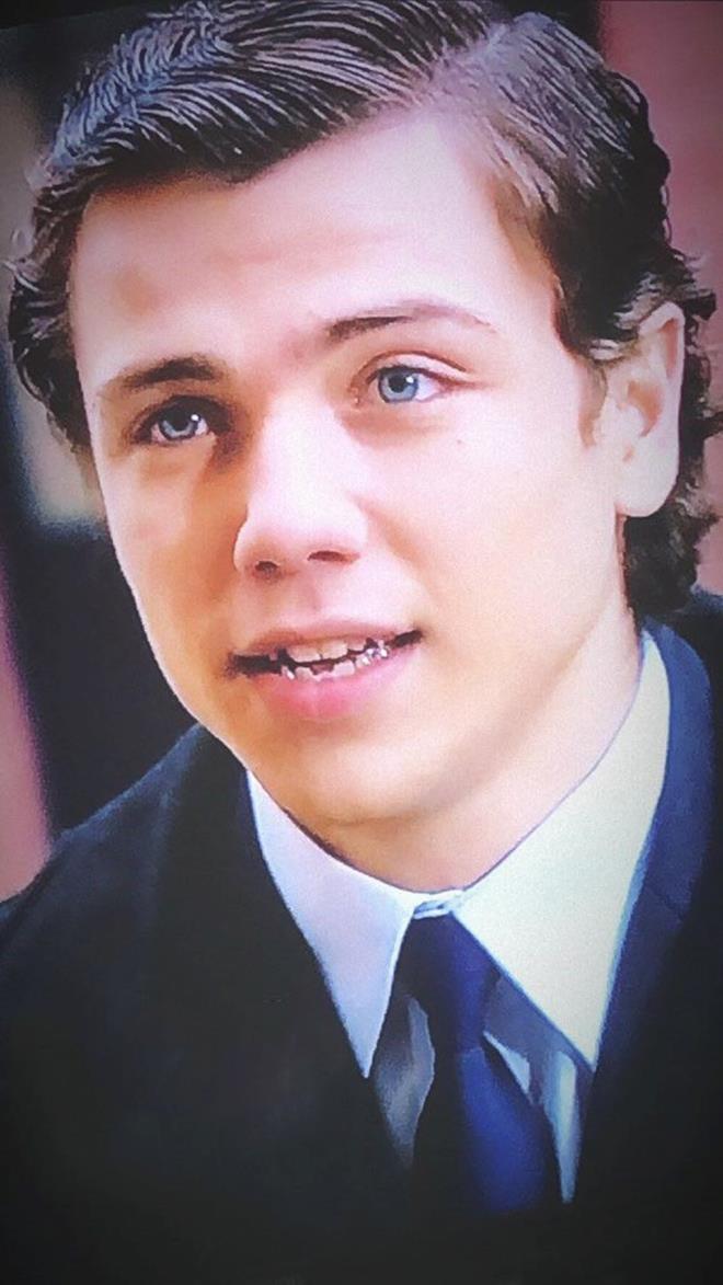 "BU ESTETE GRER BENCE"    "Estetiin var m?" sorusuna yant veren Tolga Sarta, kkken di yapsnn bozuk olduunu ve ortodonti tedavisi sonras dzeldiini "Bu estetie girer bence" szleriyle anlatt.