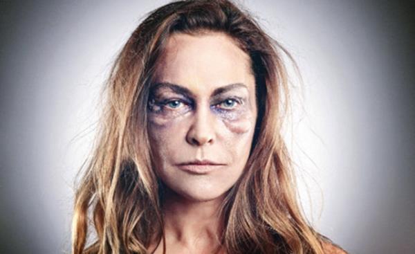 Gznze aldnz ani bir darbe ya da gznze bir cisim kamas durumda gznz ovalamaynz.