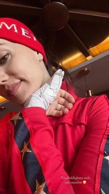 Fahriye Evcen elini sakatladn paylat kareye "Nasl olduunu asla anlamadm" notunu dt. Evcen'in ba parmann sargl olduu grld.