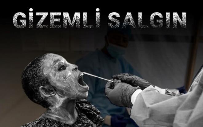 Orta Afrika lkesi Demokratik Kongo Cumhuriyeti'nde 50'den fazla kiinin lmne yol aan gizemli bir hastalk ortaya kt.