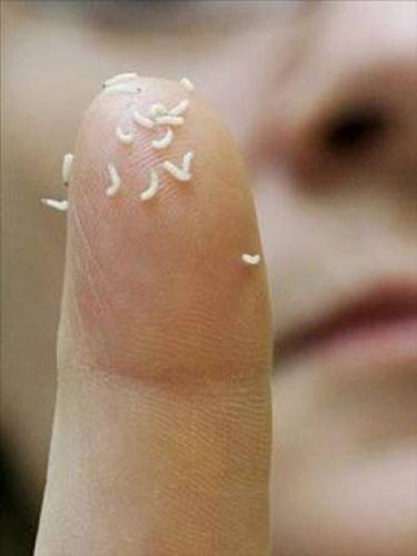 <p><b>KURTUK DEBRDMAN TERAPS</b></p>   Bir gn bu bcee sizi daha byk bir tanesinden kurtarmas iin ihtiya duyabilirsiniz. Kurtuk debridman terapisi, ak yaralara mikropsuz kurtuk ? sinek larvas ? yerletirmekle uygulanyor. Kurtuklar yara evresindeki ryen dokuyu kemirirken, geride salkl doku kalyor.Kurtuklar ayrca zararl bakterileri ldrerek yaray dezenfekte ediyor.