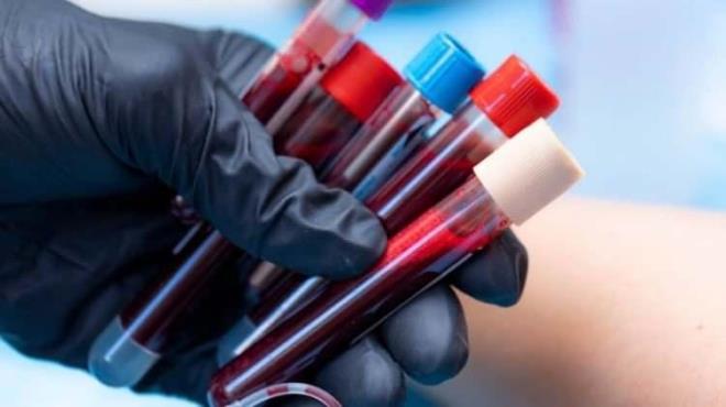 KAN GRUPLARI SNDRM SSTEMYLE LGL KANSER TRLERNDE ETKL OLABLR    Uzmanlar, kan gruplarnn zellikle sindirim sistemiyle ilgili kanser trlerinde etkili olabileceine vurgu yapyor. Farkl kan gruplarnn vcuttaki bakterilere verdii tepkilerin deikenlik gsterdiini aklayan uzmanlar, sz konusu durumun kanser geliimini tetikleyebileceine dikkat ekiyor.