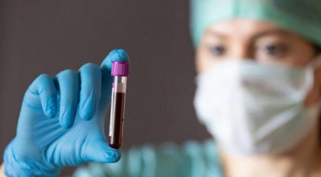 Kan gruplarnn kanser ile balantsna ynelik yaplan yeni bir aratrma, ilgin bir sonucu gzler nne serdi. 50 bin katlmcnn incelendii aratrmaya gre baz kan gruplarna sahip olan kiilerin mide kanserine yakalanma riski yzde 55 daha fazla.