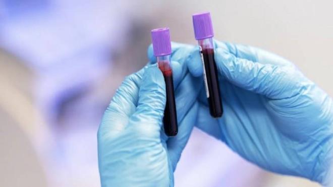 Kan gruplarnn hem karakteristik zellikler hem de salk zerindeki etkilerine ynelik yaplan aratrmalar, sk sk dikkat ekiyor. Son olarak yeni yaplan kapsaml bir aratrmann kan gruplar ve kanser riski arasndaki arpc balanty gzler nne serdii ortaya kt.