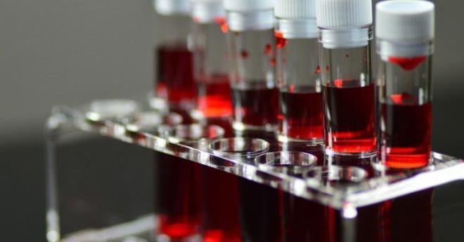 A, B VE AB GRUPLARDA RSK YZDE 55 DAHA FAZLA    ran'da 50 bin katlmcnn incelendii aratrmaya gre baz kan gruplarnn kansere yakalanma orannn daha yksek olduu belirlendi. Daily Mail'de yer alan habere gre; kan grubu A, B veya AB olan bireylerin, 0 kan grubuna sahip olanlara kyasla mide kanserine yakalanma riskinin yzde 55 daha fazla olduu belirlendi.