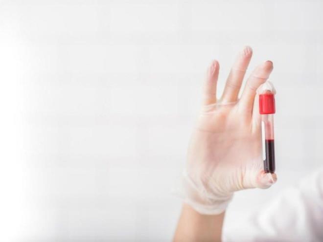 Verilerin kesin bir kan iin yeterli olmadn belirten uzmanlar, katlmc saysnn az olmasnn yan sra almada alkol/sigara tketimi gibi faktrlerin gz nne alnmadn szlerine ekledi.