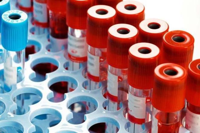 AB Kan Grubu: AB tipi kana sahip olanlar, aklclk ve uyum salama yetenei ile ne kar. Ancak, kararszlk, eletirellik ve unutkanlk gibi zayf ynleri de vardr. AB kan grubu, nadir olmas nedeniyle Japonya?da yksek takdir grr.