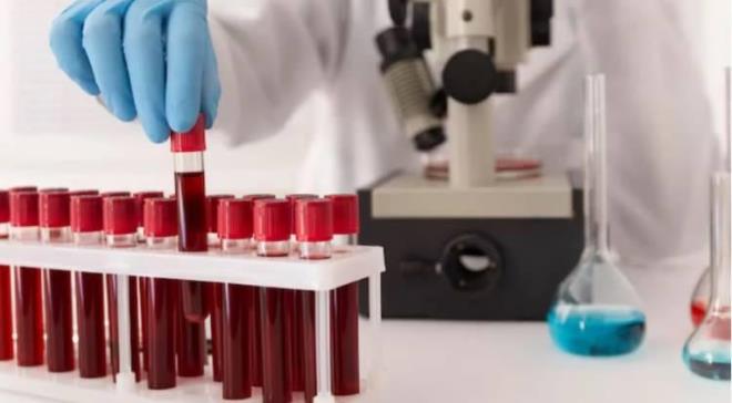 Japon bilim insanlarnn yrtt alma kapsamnda birok lkede kan grubuna gre yaplan analiz sonular artt. Japonya'da en sk grlen kan grubu zeka seviyeleriyle ynyle ne kyor. te  IQ seviyeleri yksek en zekilerin topland kan gruplar