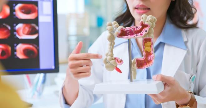 Barsak kanseri zerindeki etkiler yalnzca yaam tarzyla snrl kalmyor. Nature dergisinde yaymlanan bir alma, E. coli bakterisinin rettii ve DNA'ya zarar veren kolibaktin adl toksinin, erken yata grlen barsak kanserinin artnda rol oynayabileceini ortaya koydu.    Kaliforniya niversitesi, San Diego'dan yaplan bir aratrma, 40 ya altndaki gen hastalarn, 70 ya ve zeri hastalara gre bu toksine maruz kalmayla balantl mutasyonlar tama olaslnn 3 ila 5 kat daha fazla olduunu gsterdi.    Bu bulgular, barsak mikrobiyotasndaki dengesizliklerin, daha nce tahmin edilenden ok daha byk bir rol oynayabileceini dndryor.