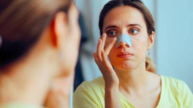 Buhar banyosunun ardndan, jojoba ya veya zeytinya gibi doal bir ya ile zellikle burun ve ene gibi siyah nokta oluumunun youn olduu blgelere nazike masaj yapn. Bu yalar, siyah noktalar yumuatarak ciltten karlmasn kolaylatrr. Masajdan sonra yznz lk suyla durulayn.