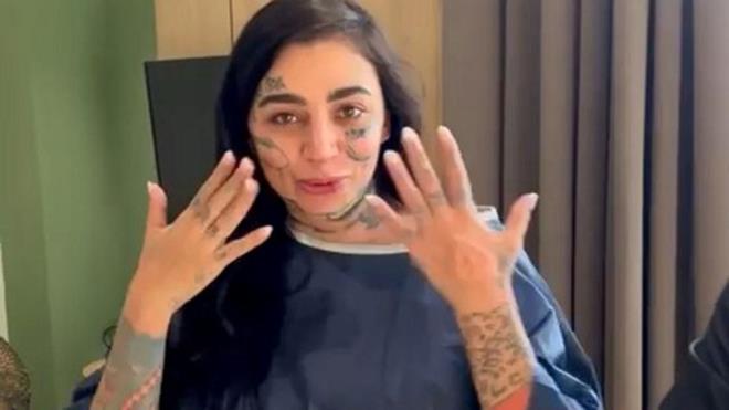 "BYKELLKTEN LSANS ALAN TEK KLNK"    Elgar Sueia, "Olay ok hzl geliti, 20-25 gnde olaya karar verildi. Benim eim, Mozambik'te ok tannan birisi olduu iin ok farkl irketlerle tantm iin i birlii yapyordu. Bu klinik, Mozambik'e geldi. Oradan hasta getirmek iin bykelilikten lisans alan tek klinik. lerini Mozambik'te tantmak iin bir sosyal medya fenomeni bulmalar gerekiyordu. Eimi buldular, ikna ettiler ve 3 gn ierisinde btn vize ilemlerimizi halledip bizi Trkiye'ye getirdiler" diye konutu.