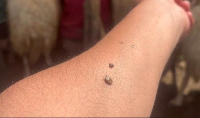 lkbahar ve yaz mevsimlerinin gelmesi ile birlikte kene vakalarnda art yaanyor. zellikle son yllarda kene srmalar sonucu meydana gelen "Krm Kongo Kanamal Hastal" lke genelinde insan saln ciddi boyutlarda tehdit ediyor.