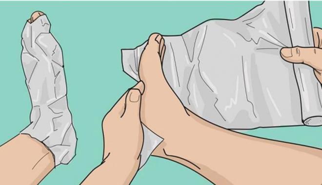 Sizlere yalnzca basit bir alminyum folyo yardmyla eklem arlarndan nasl kurtulabileceinizi anlatacaz. Alminyum folyonun ifal gc, dndnzden bile fazla olabilir... Eklem arlarn alminyum folyo ile tedavi etme yntemi, en ucuz ve en etkili yollardan biridir!