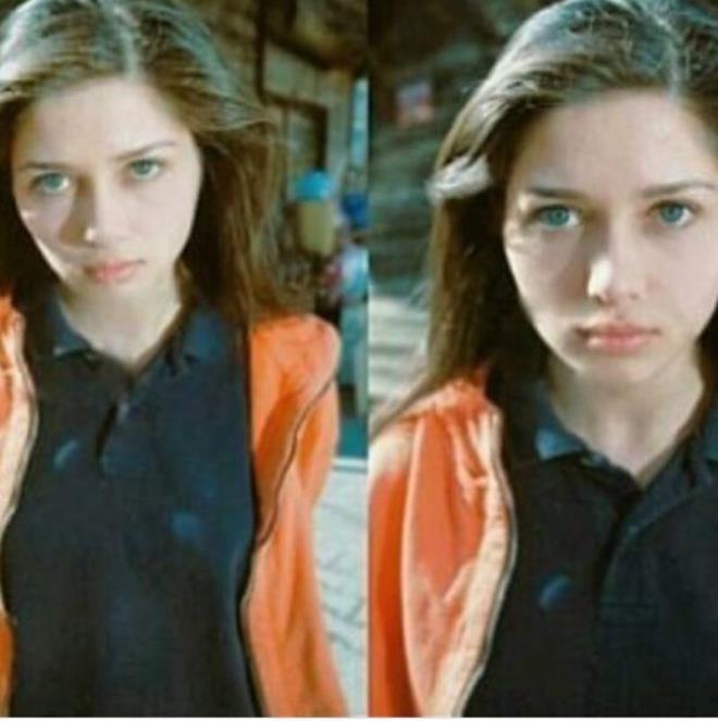 te Nurgl Yeilay'n 20'li ya hali!