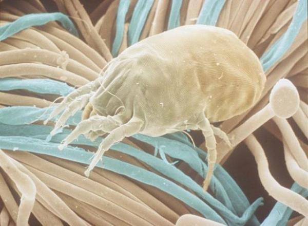 Daha kaln aknt ile birleen burun tkanmas gece grlr.