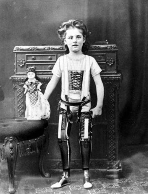 ngiltere'de yapay bacaklaryla poz veren kk kz, 1890
