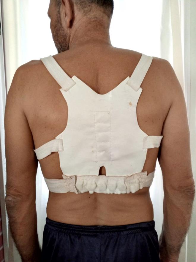 EN ETKL YNTEM EGZERSZ    Postr bozukluunda en nemli tedavi ynteminin egzersiz olduunu belirten Prof. Dr. Samanc Karaman, ?Bu korseler yerine kiiler egzersiz yapmal. Egzersizler kiiye zel planlanmal. Gn iinde aralarda mola verip srt esnetme, krek kemiklerini birbirine yaklatrp 10 saniye bekleme gibi basit egzersizler bile faydal olur. Egzersizler bir ila gibi dzenli yaplmal, aksi halde etkili olmaz" ifadeleri kullanld.