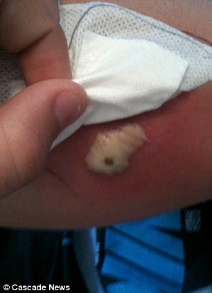 �te yandan Whitmore'un tekrar y�r�yebilmesi i�in 6 ay boyunca fizyoterapi g�recek.