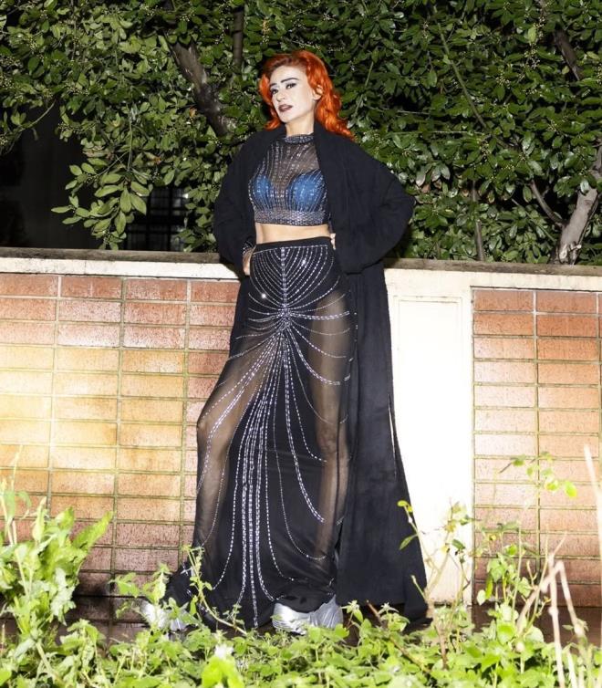 <h2 class="womanpage-gallery-detail-sub-title womanpage-gallery-detail-card-frame--sub-title">YZNDE YANIKLAR OLUMUTU</h2>              <p class="card-text gallery-page-hero-card-text"></p><p>te yandan Yldz Tilbe, aylar nce de yaad talihsiz bir kazayla gndem olmutu.</p>  <p>San boyadktan sonra uyuyakalnca yznde yaralar oluan 59 yandaki nl isim,&nbsp;"Bir daha sama boya srmeyeceim. Kimyasal yank oldum" ifadelerini kullanmt.</p>