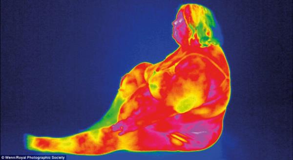 Termal kameralarla ya ve kas dokusu grnebiliyor..