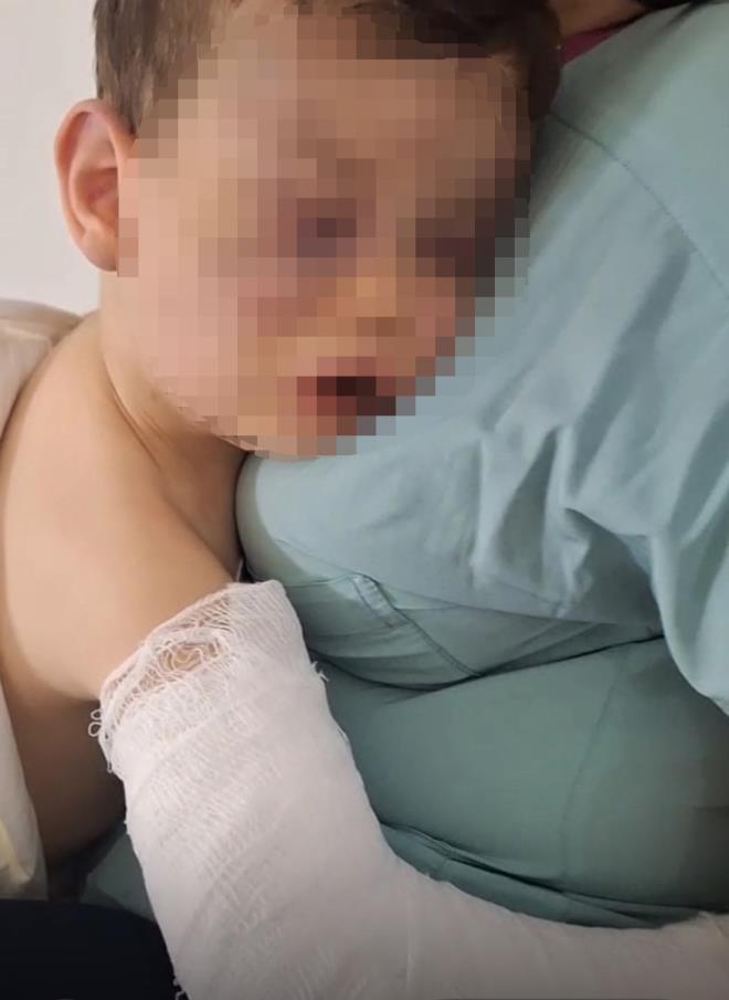 <strong>Aren Bebek Darbedildi</strong><br>  Denizli'de 2 yandaki Aren bebek, annesi ve sevgilisi tarafndan darbedildi. Vcudunda ok sayda darp izi bulunan ocuk hastaneye kaldrld.